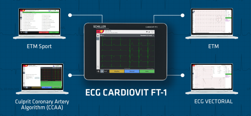Corazón de atleta, ECG criterios de Seattle