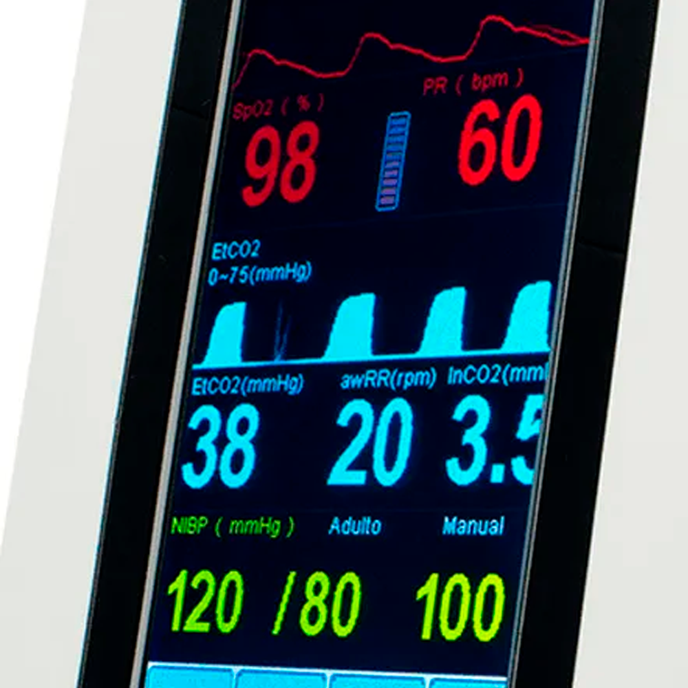 Tranquility VS es un monitor portátil para pacientes neonatales, pediátricos y adultos. Se puede configurar para medir cualquier combinación de presión arterial no invasiva, SpO2, temperatura rápida y capnografía.