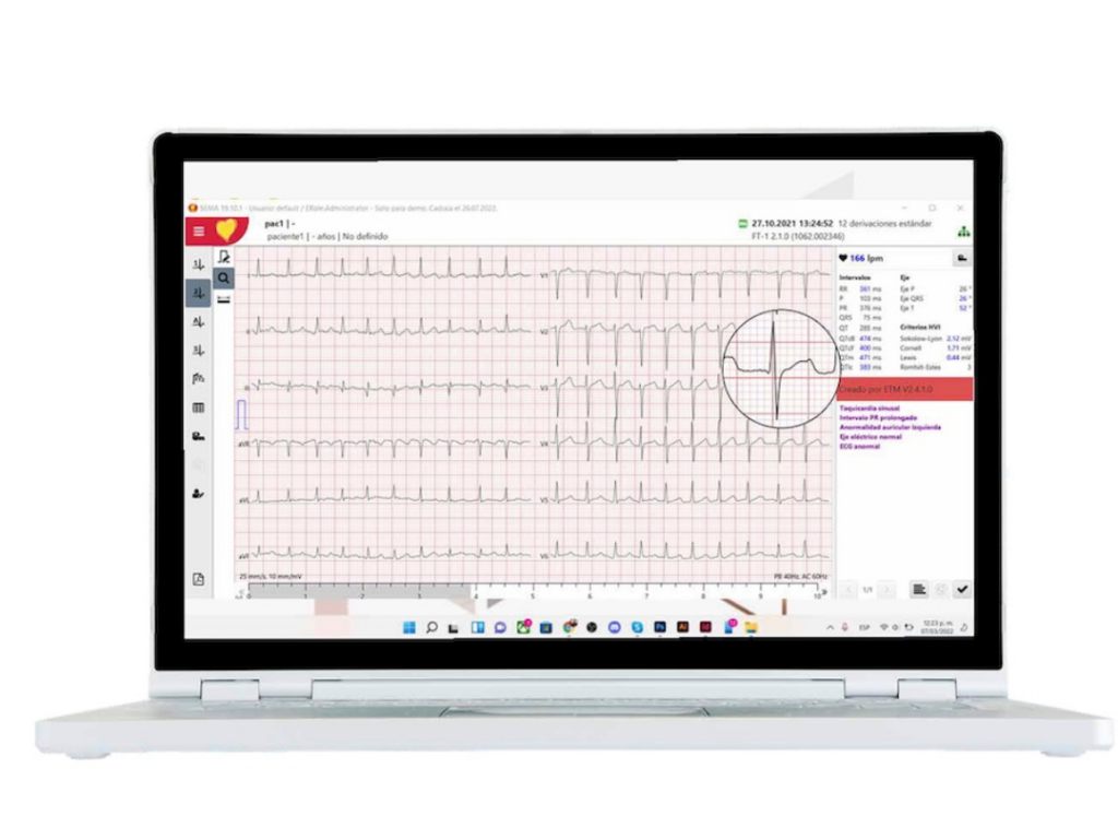 Algoritmo cardíaco ETM