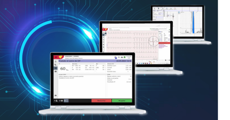 Algoritmos cardiacos innovadores