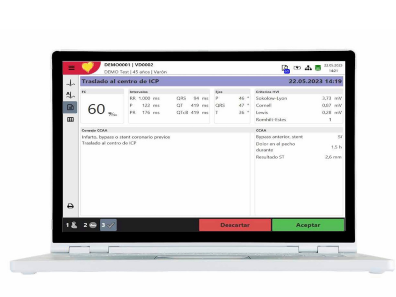 Captura de pantalla del algoritmo de Arteria Coronaria Culpable para localización precisa de obstrucción coronaria en ECG