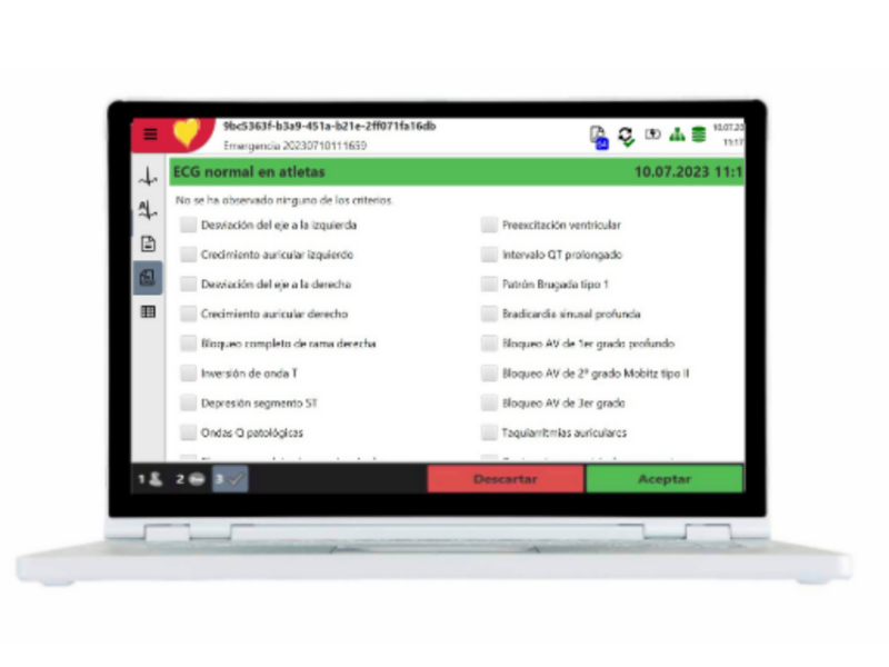 Captura de pantalla del algoritmo ETM Sport para interpretación de ECG en atletas conforme a los criterios de Seattle