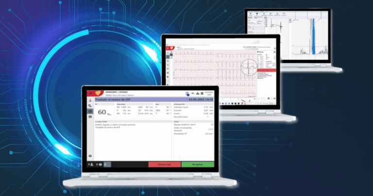 Capturas de pantalla de softwares avanzados para diagnóstico cardiopulmonar con ECG, pruebas de esfuerzo y ergoespirometría