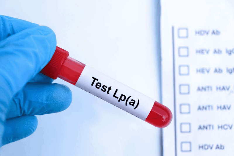 Muestra de sangre con la etiqueta “Lp(a) Test” utilizada para ilustrar la medición de lipoproteína(a) como factor de riesgo cardiovascular.