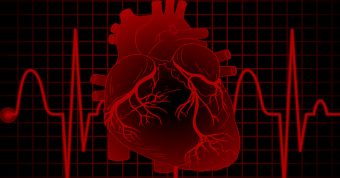 GUIA ESC 2022 ARRITMIAS VENTRICULARES