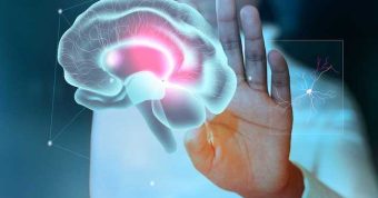 Hemorragia Intracerebral Espontánea