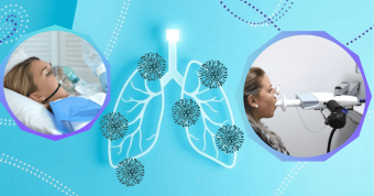 Disfunción de la membrana alveolo-capilar en pacientes con síndrome posCOVID durante evaluación pulmonar.