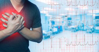 Persona con síntomas de infarto al miocardio, relacionado con investigación sobre exosomas cardíacos